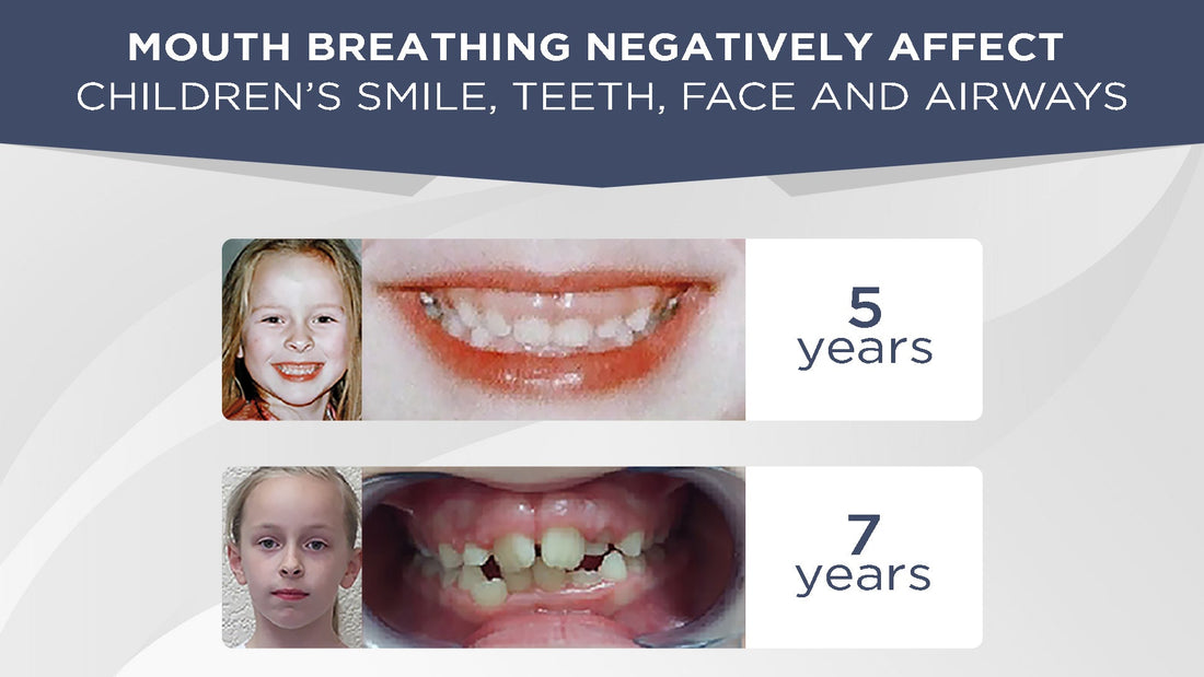 Mouth breathing negatively affects children's smile, teeth, face and airways - Conscious Breathing Institute